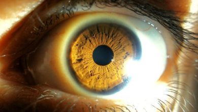Фото - 5 болезней, которые можно определить по состоянию глаз